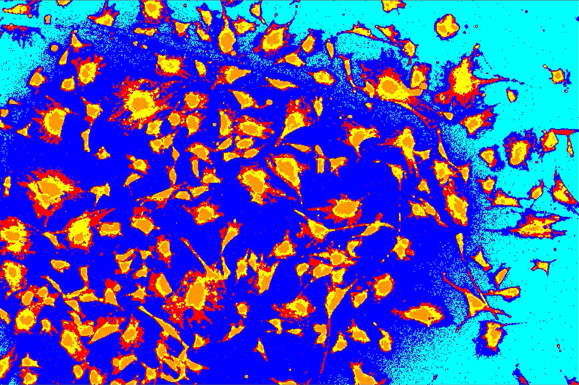 A blue and orange backgroundDescription automatically generated