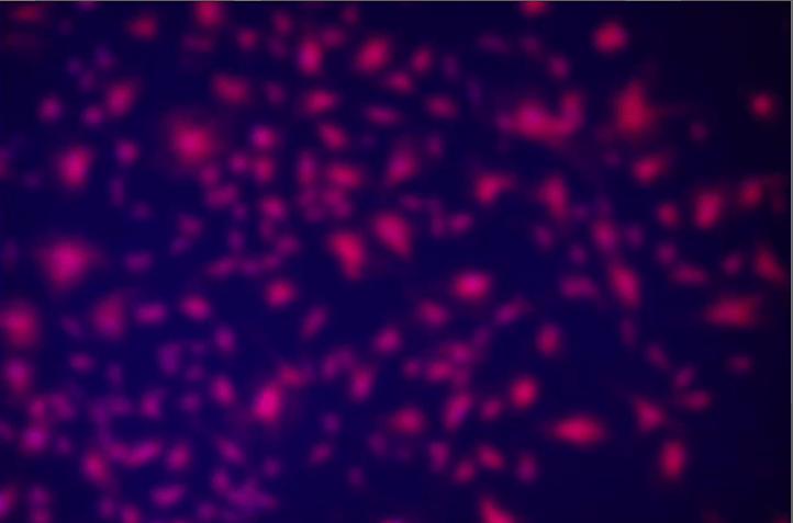 A blurry image of pink spots Description automatically generated