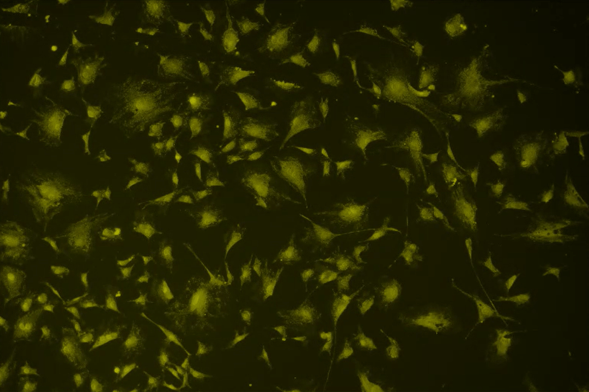 A close up of a black backgroundDescription automatically generated