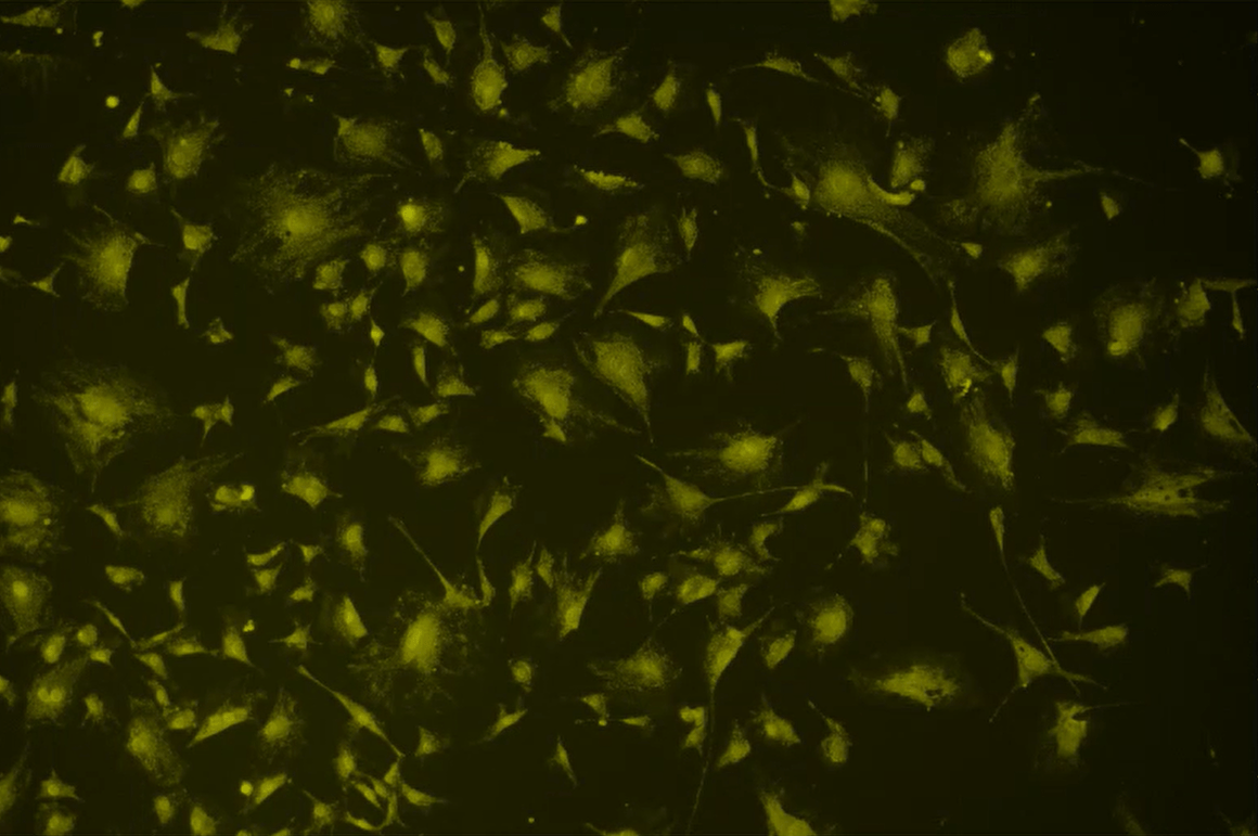 A close up of a black backgroundDescription automatically generated