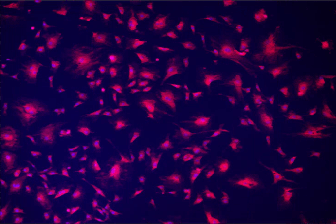 A close-up of pink particles Description automatically generated