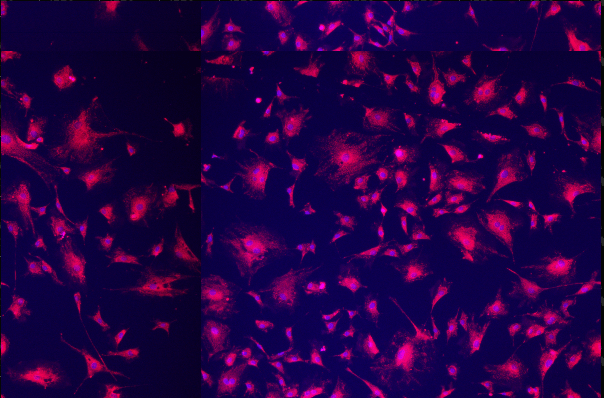 A collage of pink and purple cells Description automatically generated