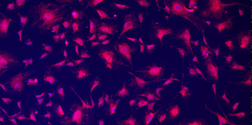 A group of pink and purple cells Description automatically generated with medium confidence