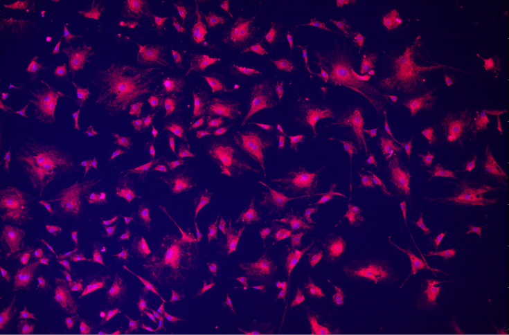 A pink and purple cells Description automatically generated with medium confidence