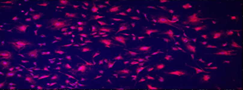 A purple and pink spots Description automatically generated with medium confidence