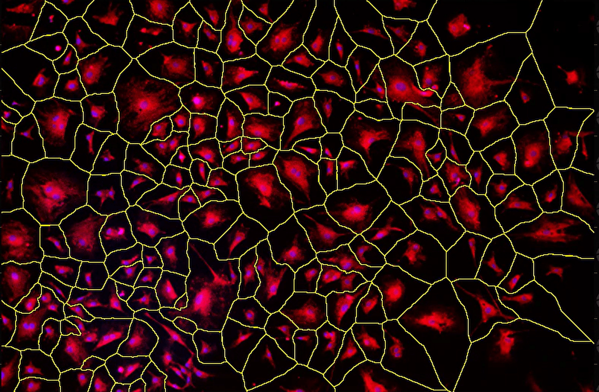 A red and yellow cells Description automatically generated