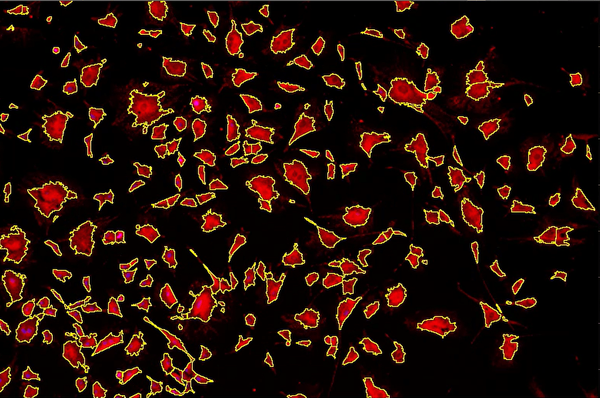 A red and yellow spots on a black background Description automatically generated