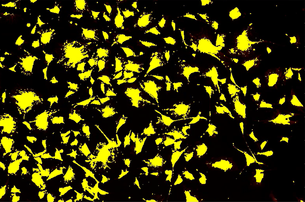 A yellow and black background Description automatically generated