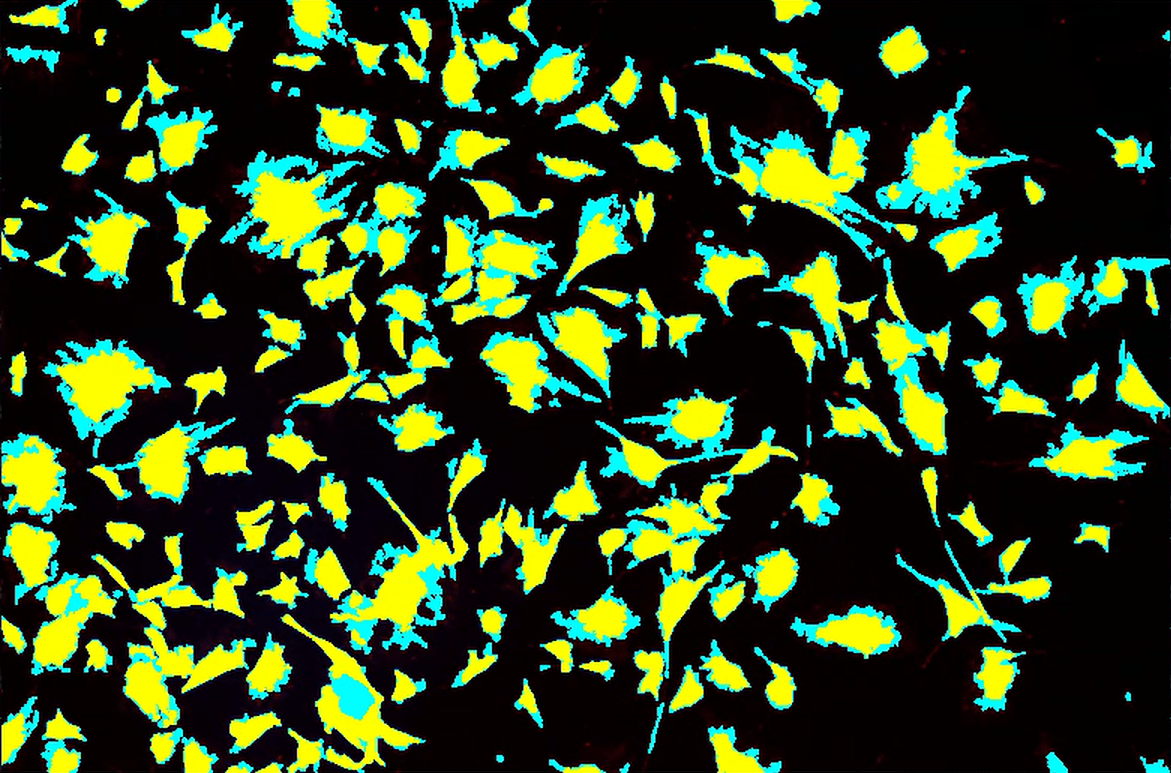 A yellow and blue spots on a black backgroundDescription automatically generated