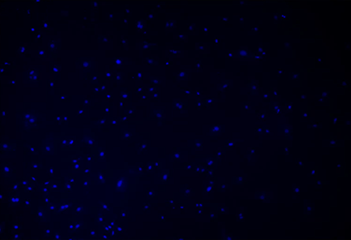 Blue dots in the darkDescription automatically generated