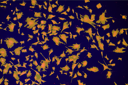 A blue background with orange and yellow spots Description automatically generated