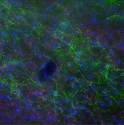 A close-up of a green and blue cell Description automatically generated