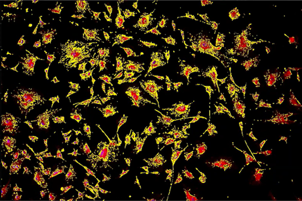 A yellow and red spots on a black backgroundDescription automatically generated