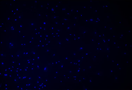 Blue dots in the dark Description automatically generated